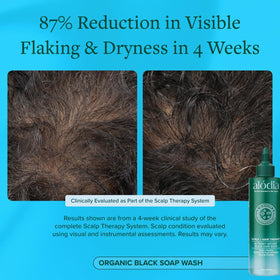 Product packaging of ALODIA Nutrient-Infused Black Soap Wash front view.