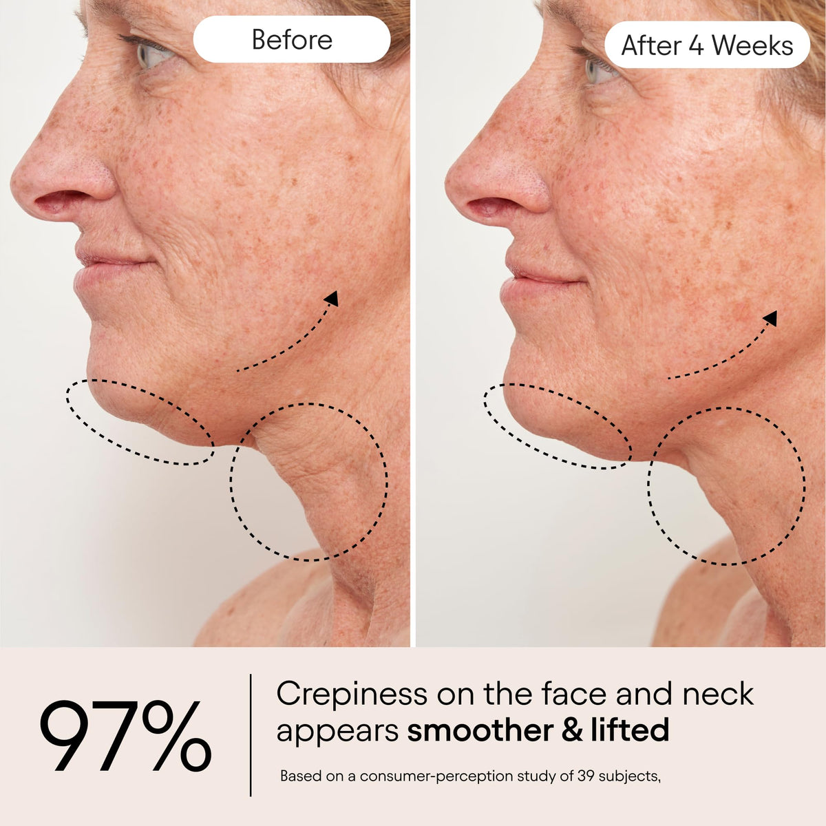 Alpyn Beauty ingredient close-up featuring apple fruit extract.