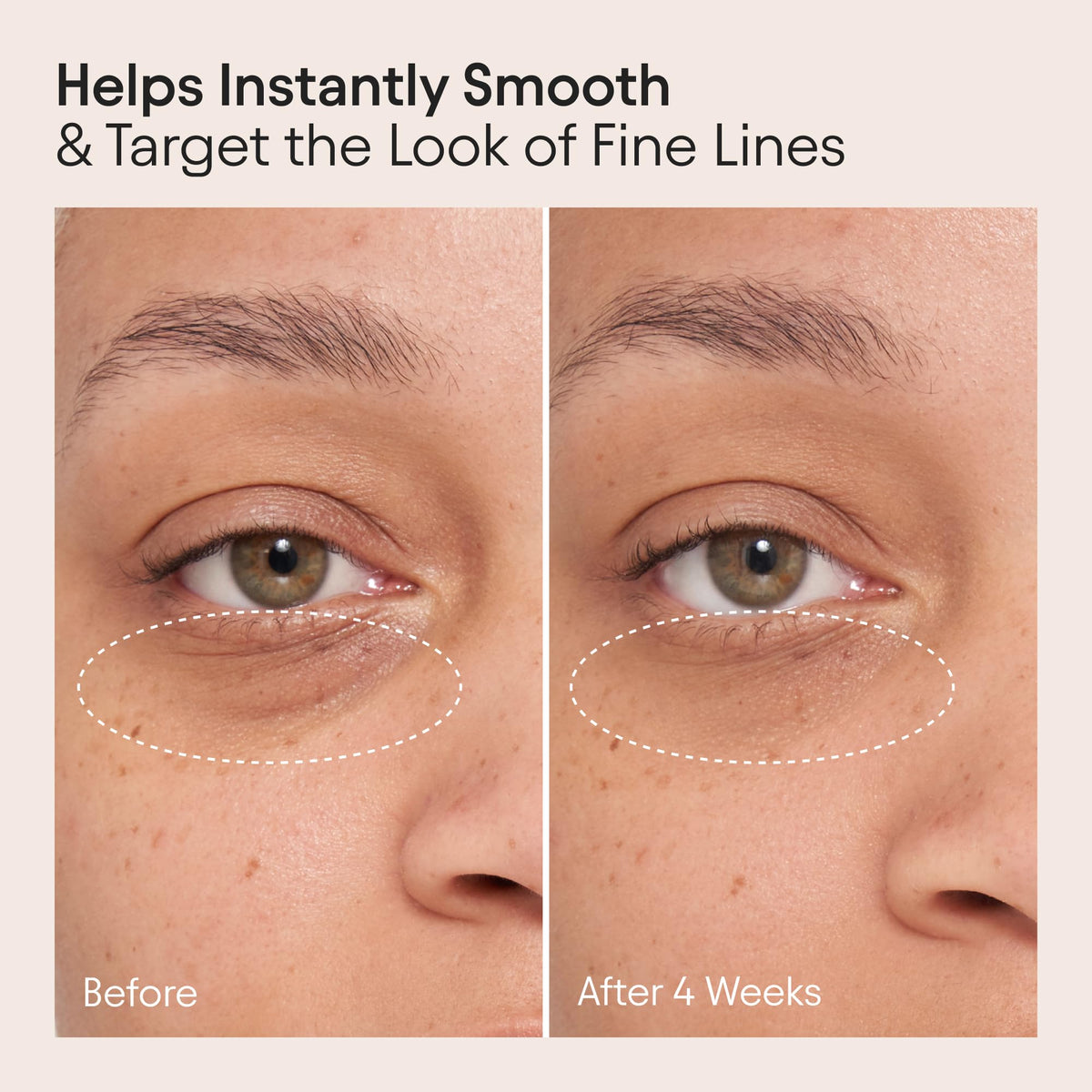 Alpyn Beauty Line-Filling Eye Balm bakuchiol active close-up, suggesting smoother-looking fine lines.