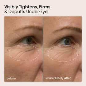 Alpyn Beauty Line-Filling Eye Balm texture close-up reveals cooling, soothing sensation.