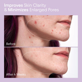 Close-up of the liquid exfoliator on skin for brighter, smoother texture