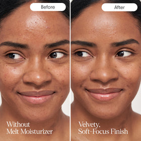 Alpyn Beauty Melt Moisturizer Bakuchiol highlights phyto-retinol for subtle glow.