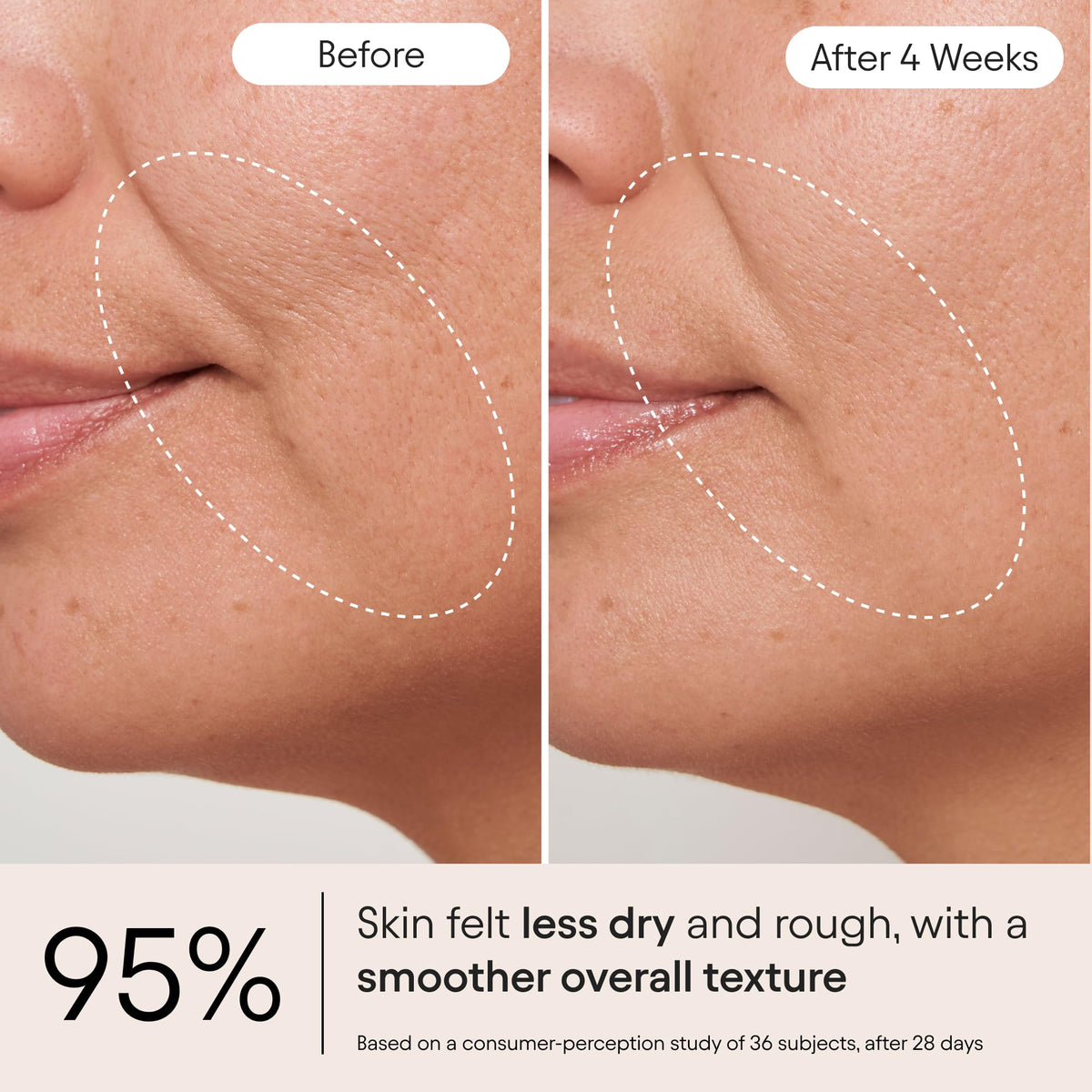 Alpyn Beauty Melt Moisturizer with velvet finish ideal for smoothing the surface.