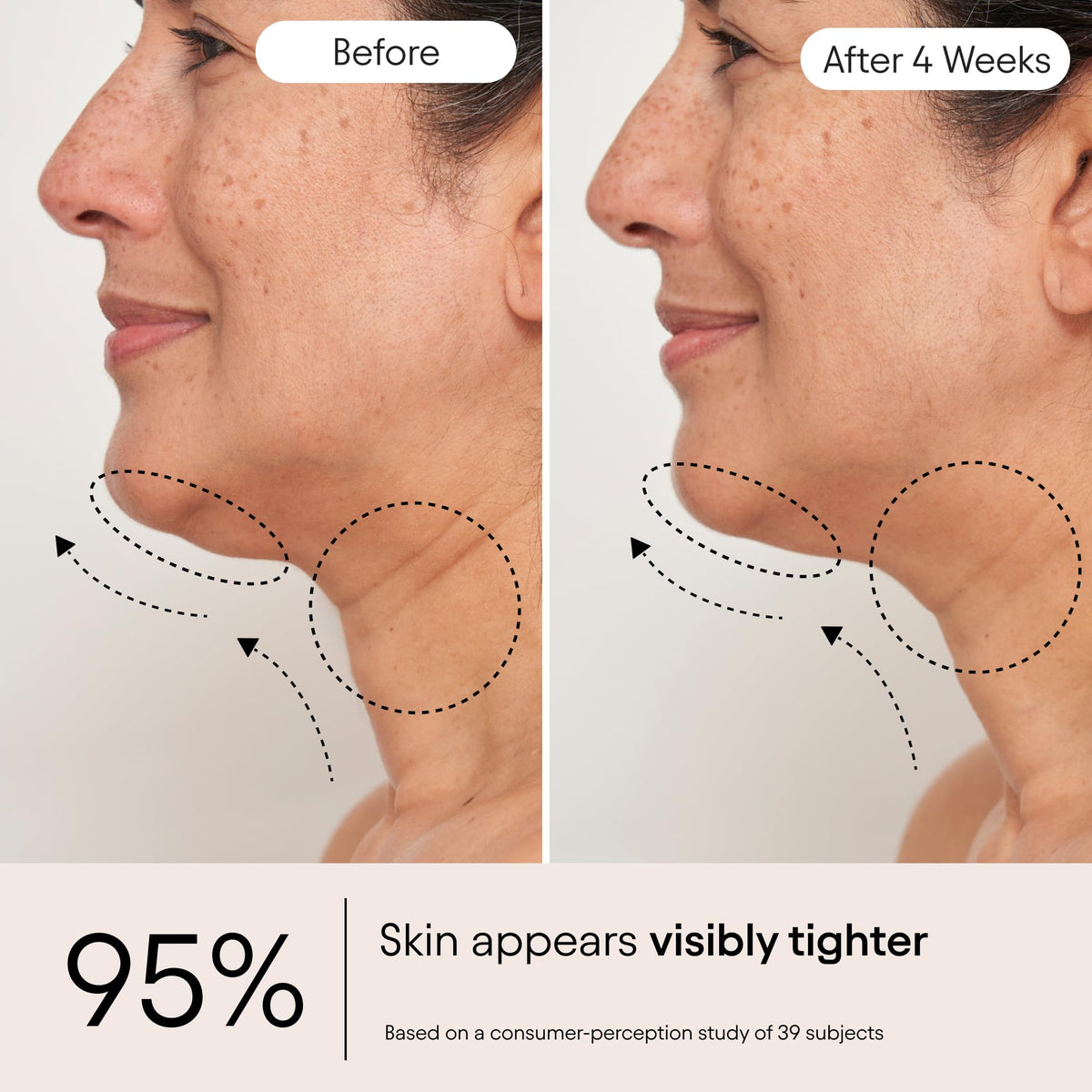 Alpyn Beauty neck and décolleté application for a smoother look.