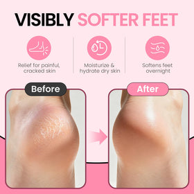 ALUROICE silicone material close-up highlighting soft stretchy texture