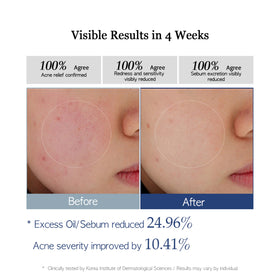 AlwayNu Re.SPN toner pad calming essence promotes nourished, comfortable skin.