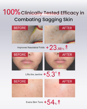 AMIRO PDRN Serum demonstrates a noticeable glow with continued use.