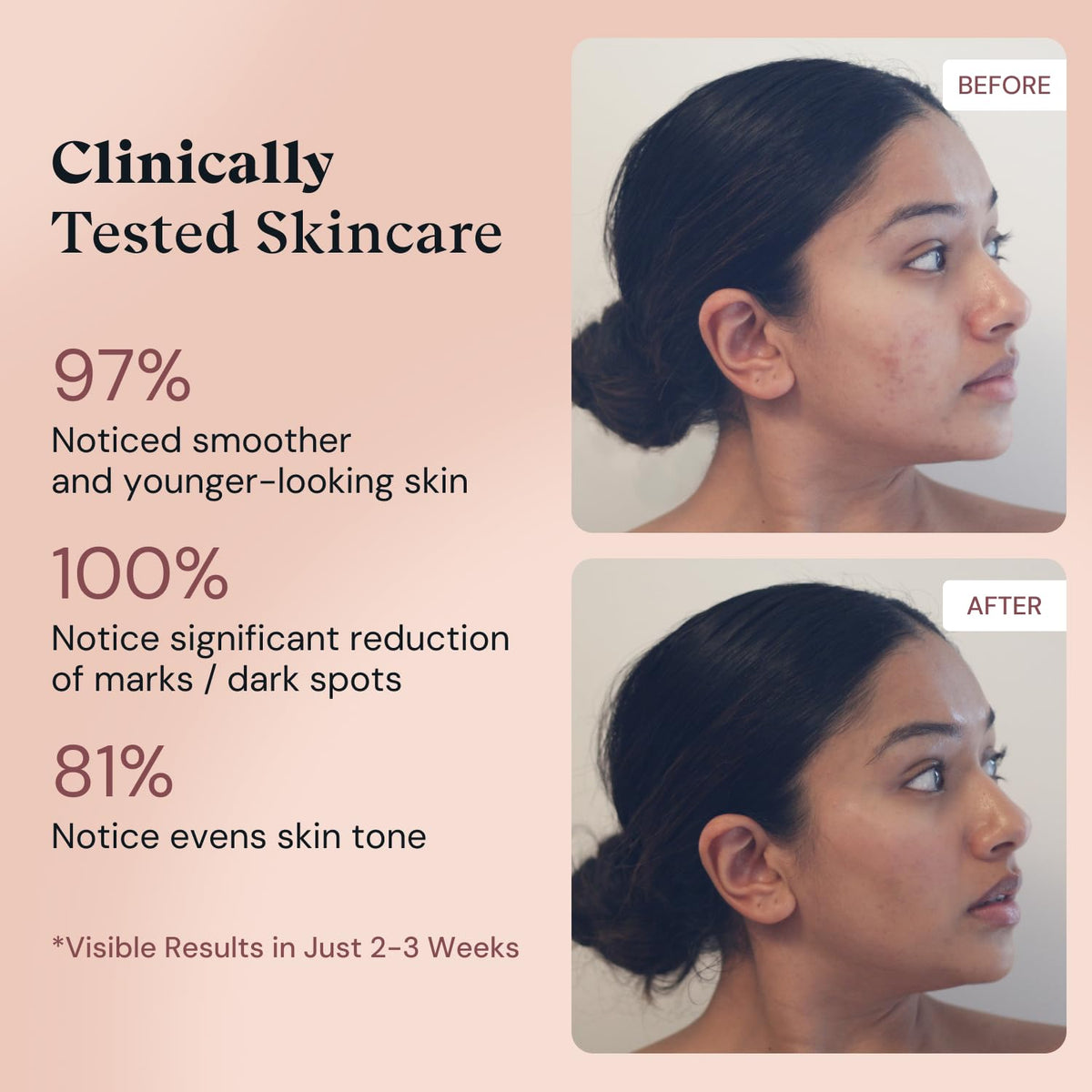 Serum texture on skin showing hydration and dewy glow with Amour De Moi