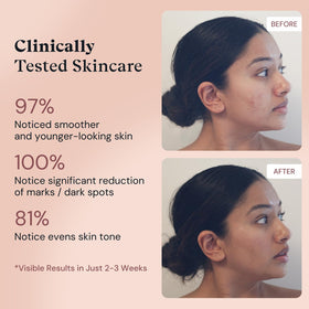 Serum texture on skin showing hydration and dewy glow with Amour De Moi