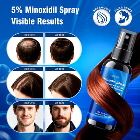 AMRWRIR biotin and castor oil blend suggests nourishing scalp support.