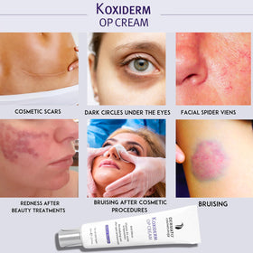 Anacis Vitamin K1 Oxiderm Cream reduces under-eye puffiness for smoother skin.