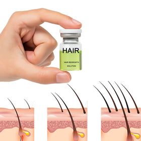 ANEFOSE Hair Regrowth System bottle label; clear ingredient list and usage guidance.