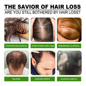 ANEFOSE Hair Regrowth System daily routine; simple steps fit into busy mornings.