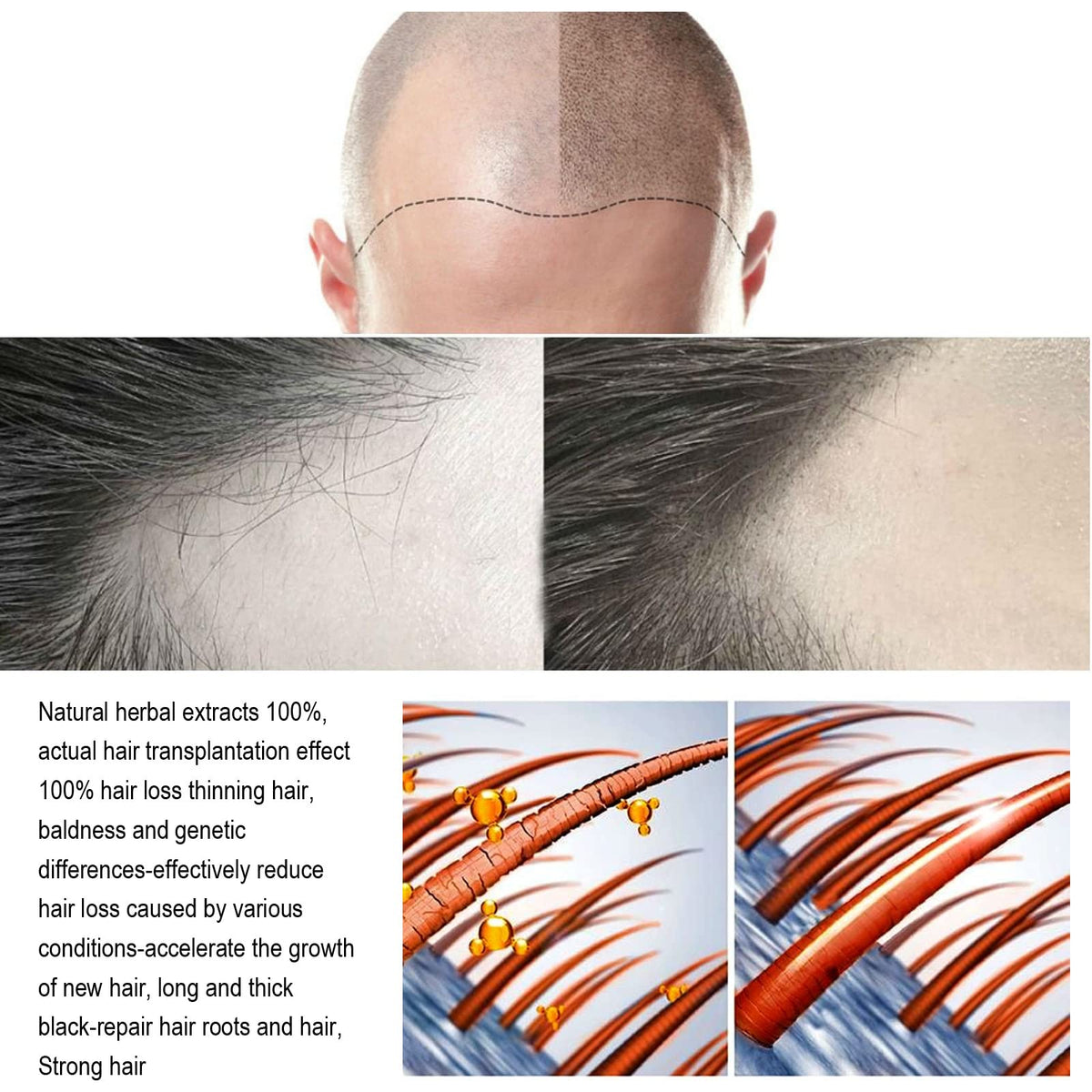 ANEFOSE Hair Regrowth System fuller-hair look; visual concept after consistent use.