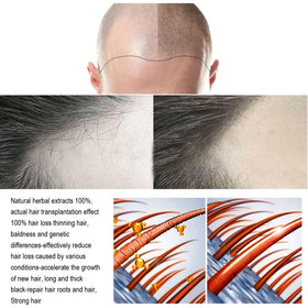 ANEFOSE Hair Regrowth System fuller-hair look; visual concept after consistent use.