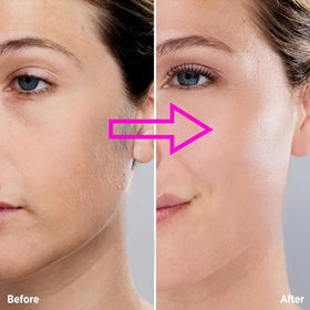 Angel Kiss Gen 3 twist-lock system secures heads during use