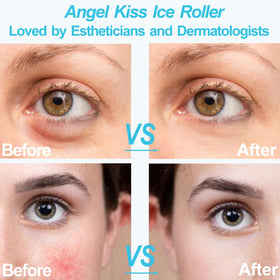 Angel Kiss Ice Roller used before makeup for a glowing canvas.