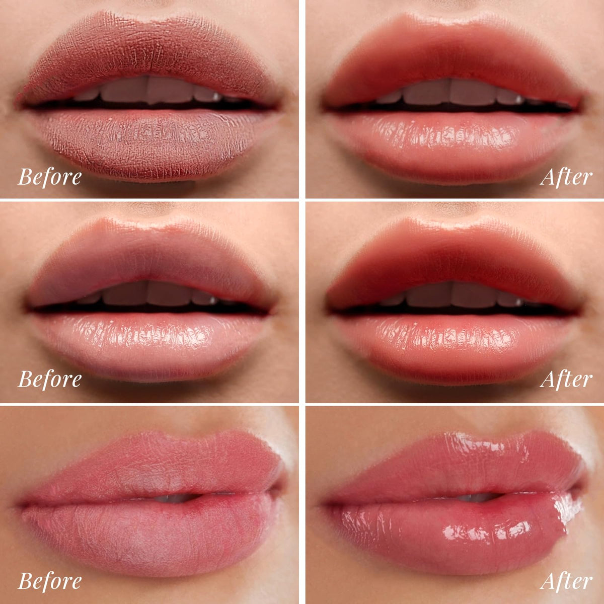ANRCOLLECT lip care kit flat lay showcasing the 4 piece set