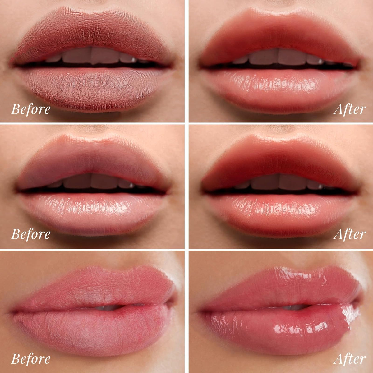 ANRCOLLECT lip care kit: convenient 4-pack for daily ritual and travel-ready lips.