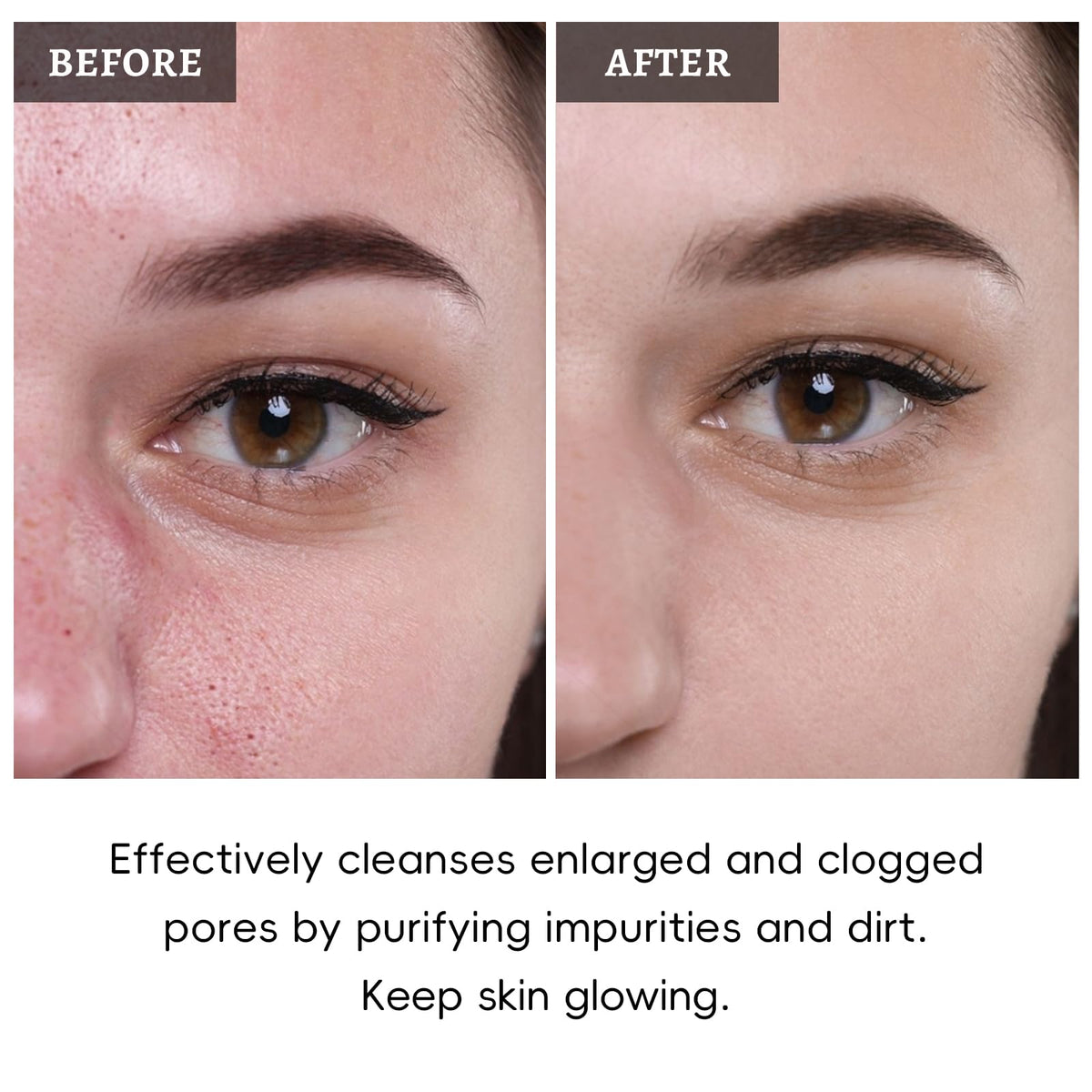 ANRCOLLECT oil-balance-clay-mask helps refine skin and reduce shine.