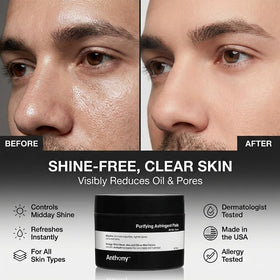 Anthony Witch Hazel Pads exfoliation closeup showing cleansing action and texture.