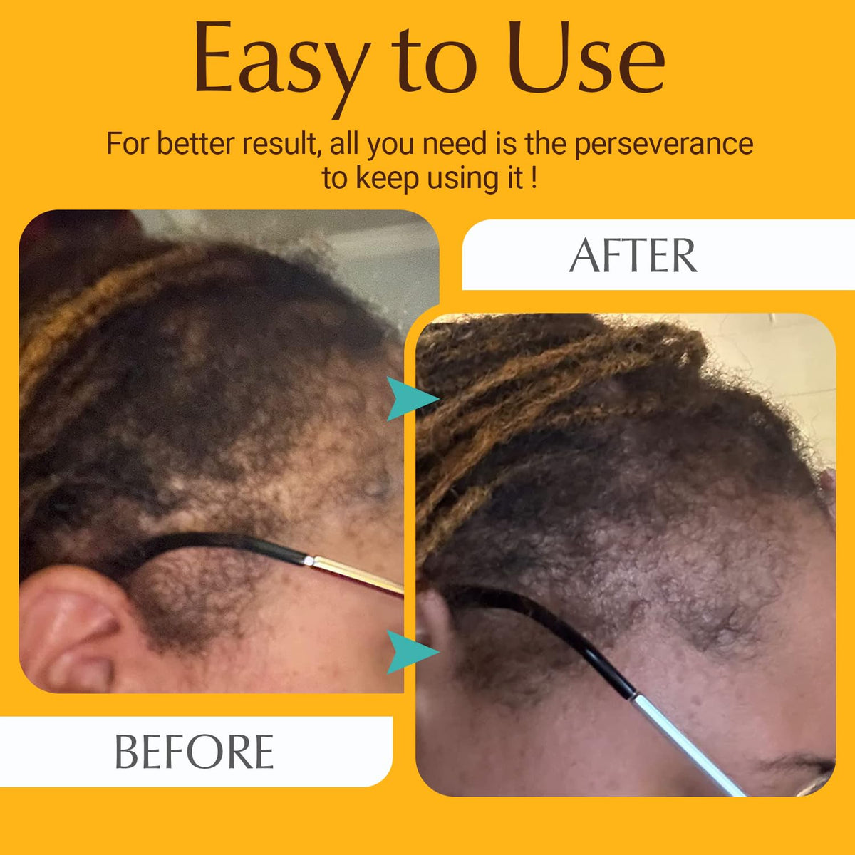 ANTMPO Hair Growth Comb closeup reveals compact design for easy packing.