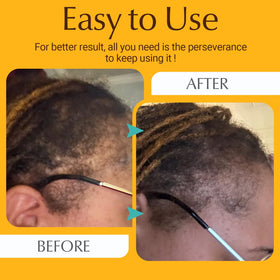 ANTMPO Hair Growth Comb closeup reveals compact design for easy packing.