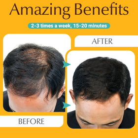 ANTMPO Hair Growth Comb travel case suggests on-the-go maintenance.