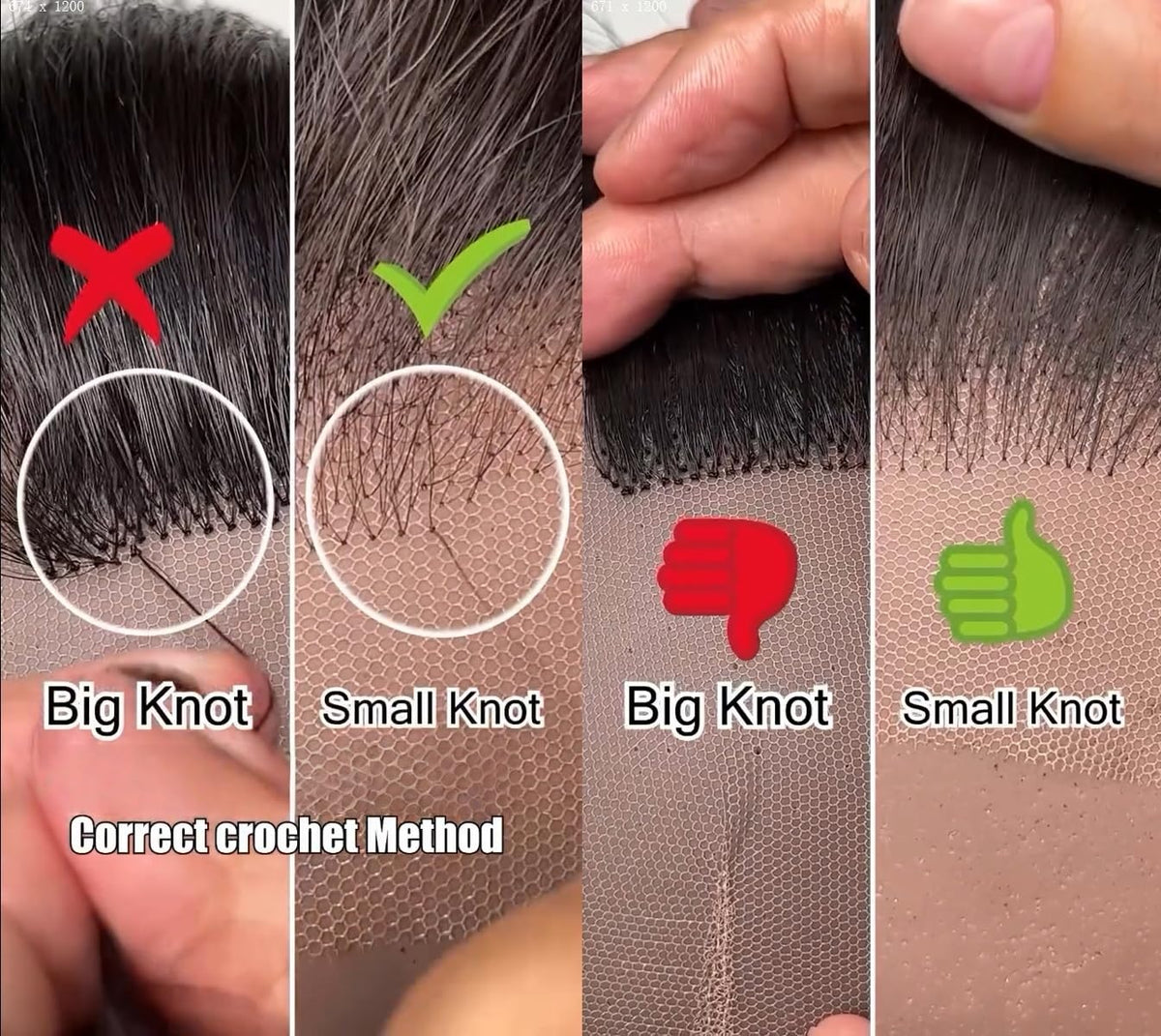Anvnkl easy-install lace closure supports quick adjustments.