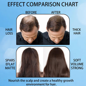 Aparthy rollerball in action enabling easy direct application to the scalp.