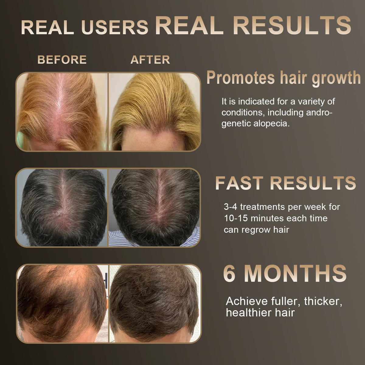 Apbier Laser Hair Growth Comb travel case included.