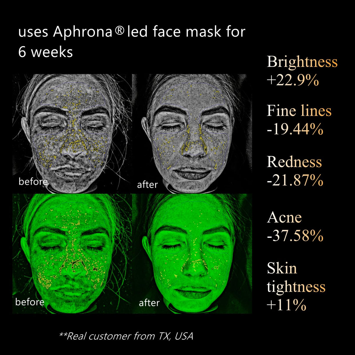 Aphrona Halo Face Mask close-up showing evenly distributed LED chips.