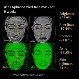 Aphrona Halo Face Mask close-up showing evenly distributed LED chips.
