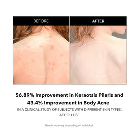 APRILSKIN Carrotene IPMP Exfoliating Body Wash features ceramide and panthenol for moisture