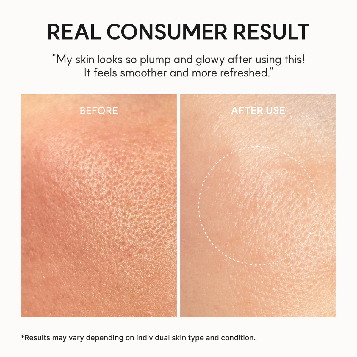 Arencia NAD+ Serum Booster Shot daily routine step on skin.