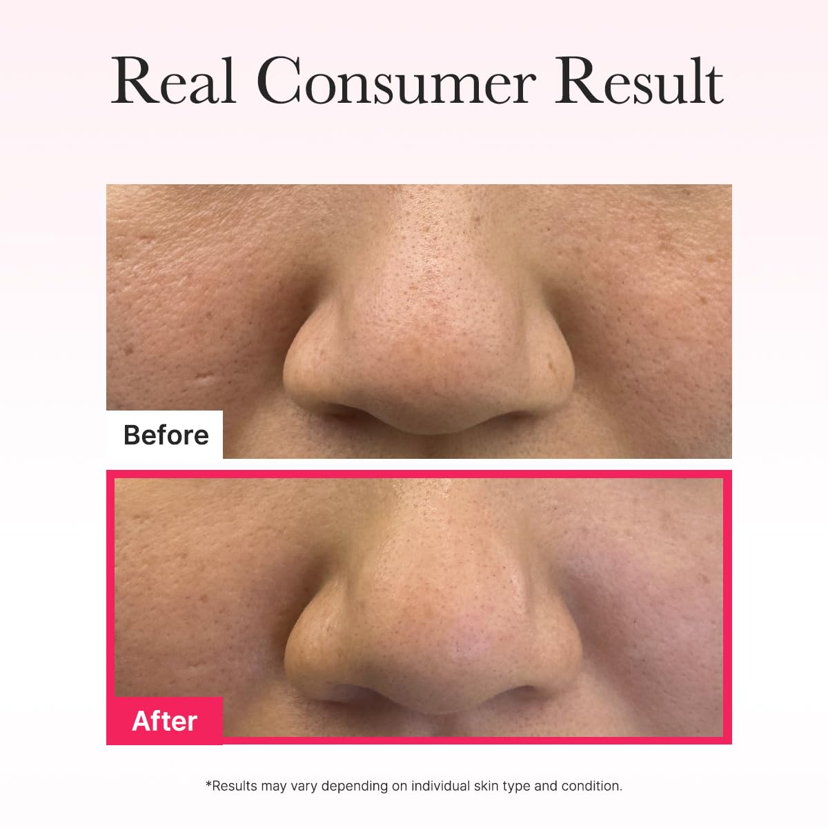 ARENCIA Red Collagen Jello Mask night-use for overnight care