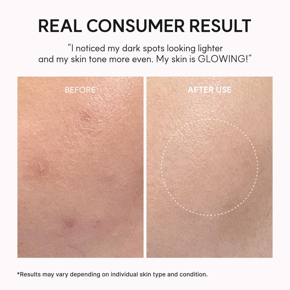 Arencia TXA Booster Shot Serum ingredient list featuring ceramides and hyaluronic acid.