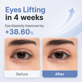 AROCELL Botulcare under-eye hydration swirl emphasizing deep moisture for delicate skin.