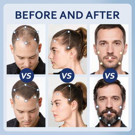 Artimore castor oil component image emphasizing conditioning properties for resilient strands