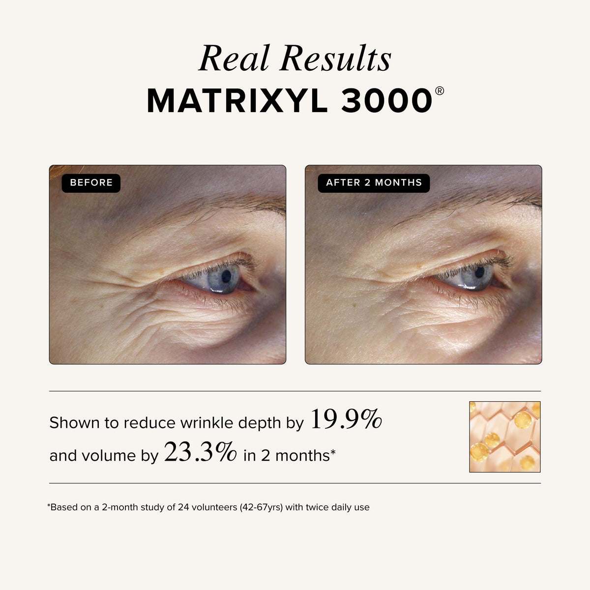 Asterwood night-time application shows targeted wrinkle care as you sleep.