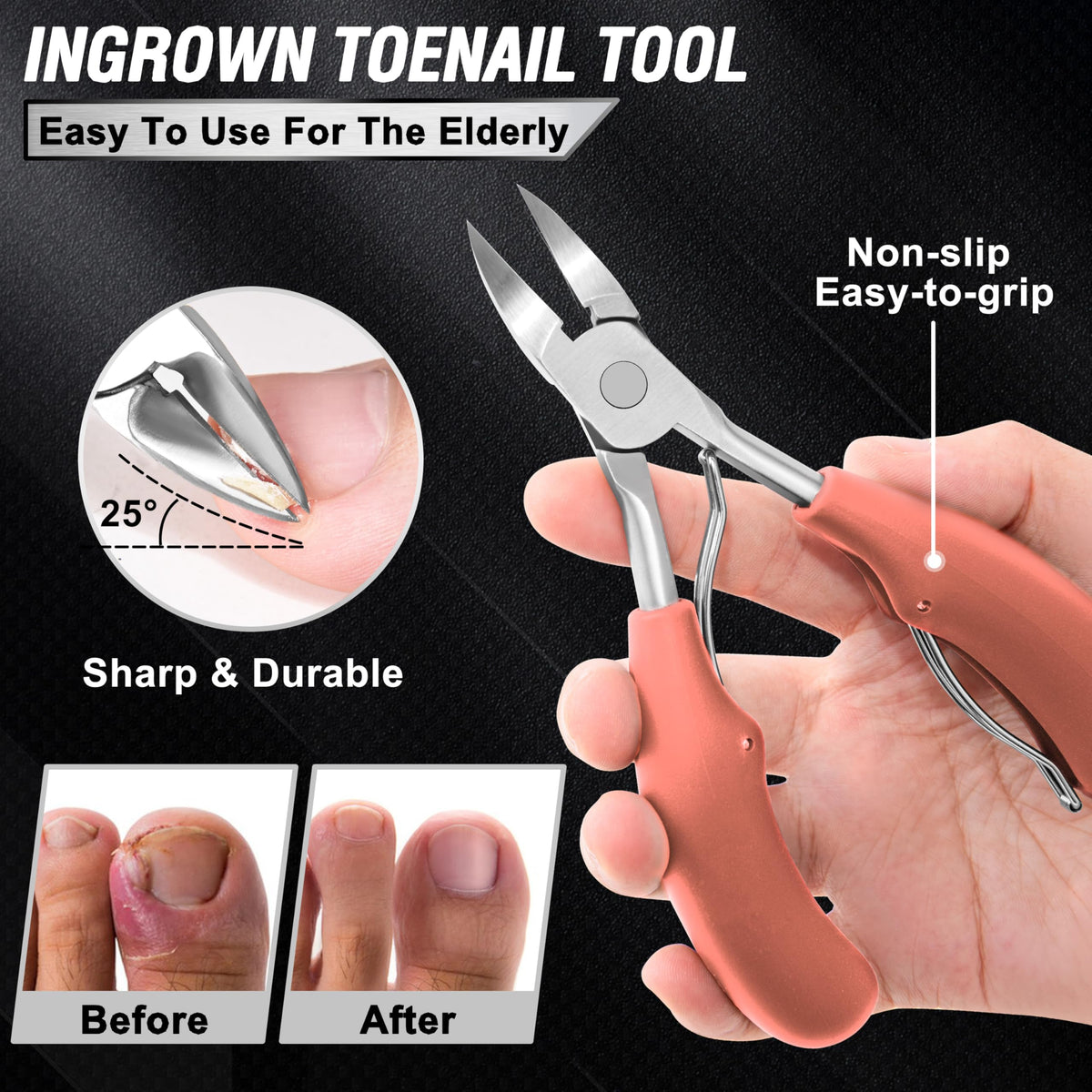 Aucurwen ingrown toenail tool helps manage trouble spots with precise handling.