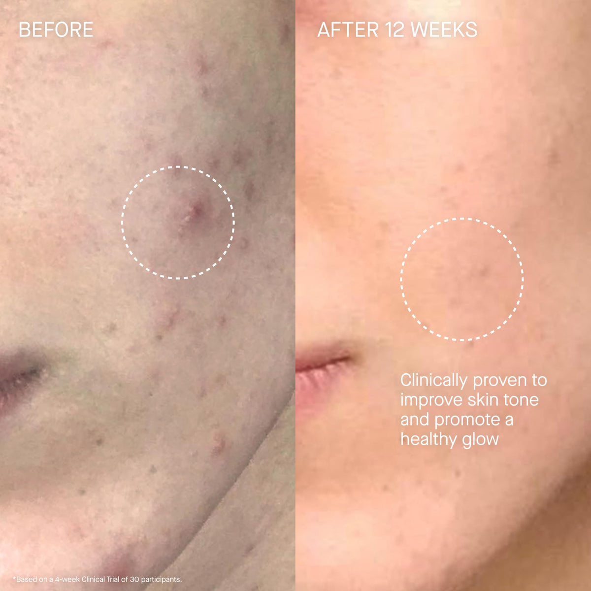 Augustinus Bader The Cream glow on skin hints at even tone and hydration