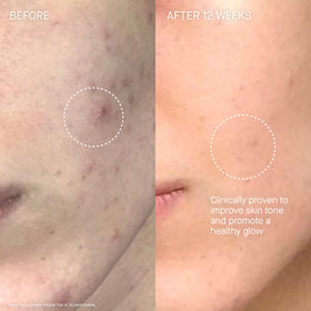 Augustinus Bader The Cream glow on skin hints at even tone and hydration