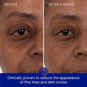 Augustinus Bader Eye Patches smooth fine lines around the eyes.