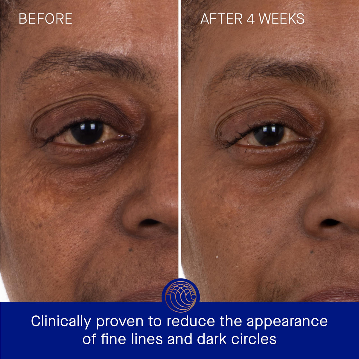 Augustinus Bader Eye Patches under-eye application demonstrates calming, quick refresh