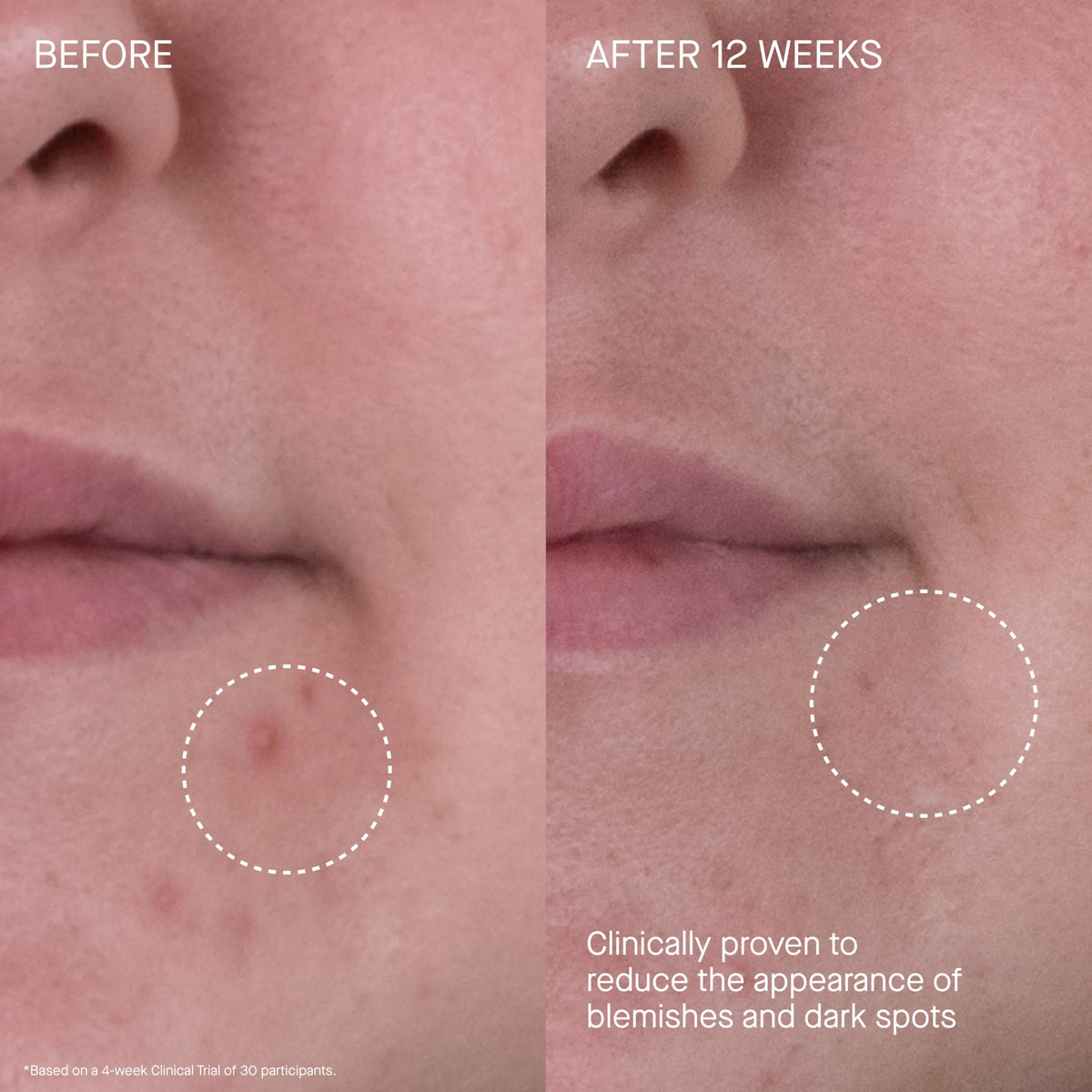 Glow and even tone focus on skin treated with Rich Cream