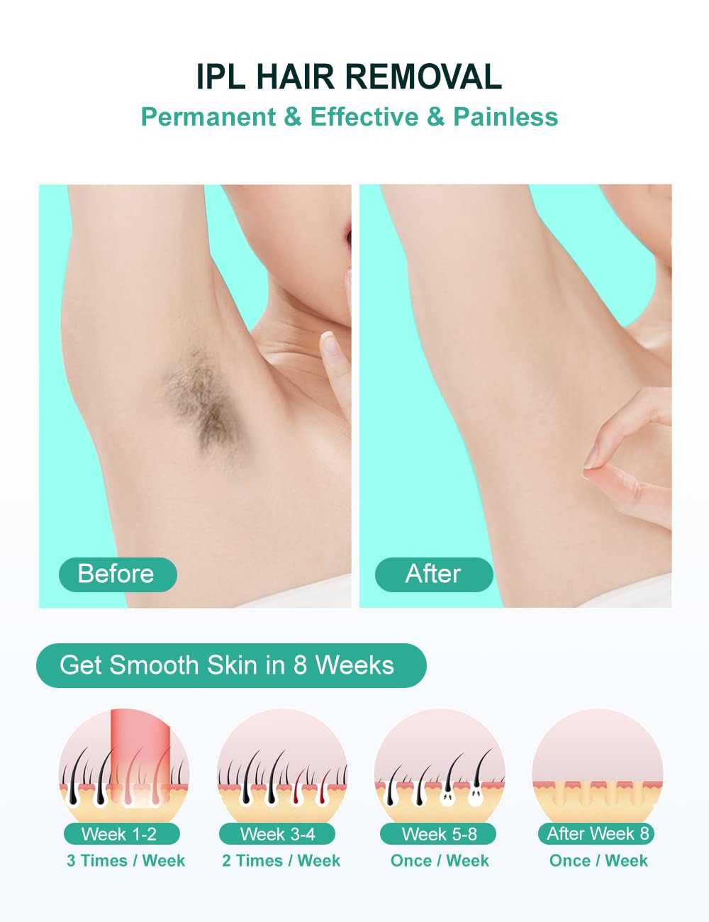 AUITRONCARE IPL device used on underarm area for quick hair reduction.