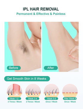 AUITRONCARE IPL device used on underarm area for quick hair reduction.
