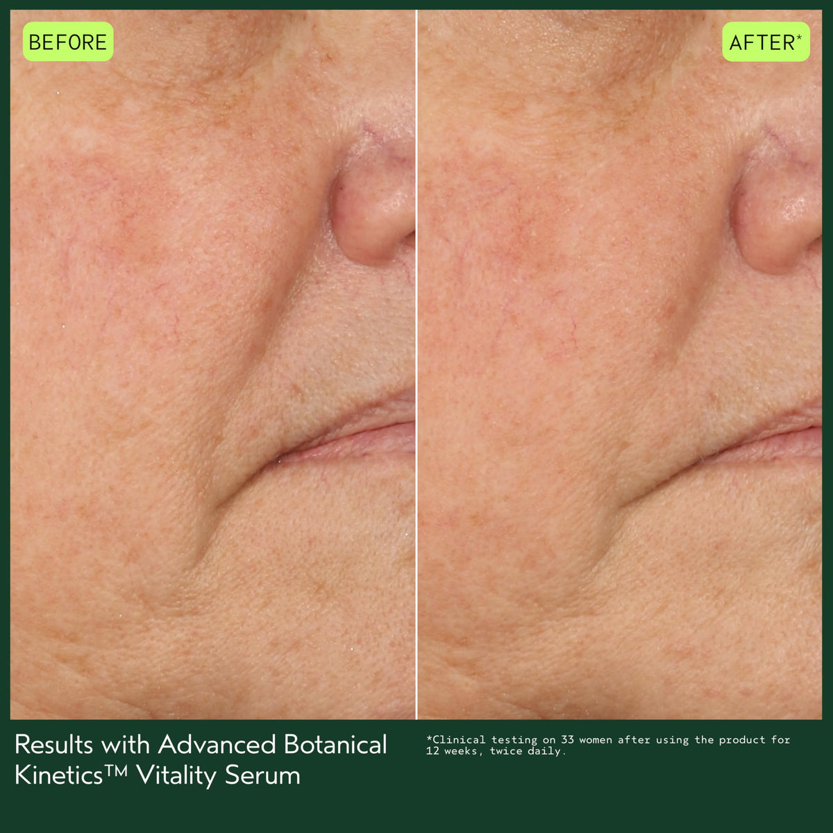 Texture close-up shows lightweight, fast-absorbing serum on skin.