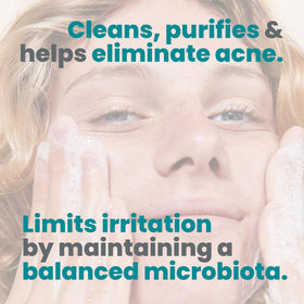 Avène Cleanance acne clearing gel applied on face during routine cleansing